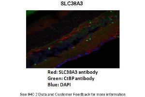 Immunohistochemistry (IHC) image for anti-Solute Carrier Family 38 Member 3 (SLC38A3) (N-Term) antibody (ABIN2775351)