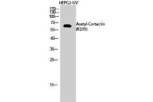 Western Blotting (WB) image for anti-Cortactin (CTTN) (acLys235) antibody (ABIN3178875) (Cortactin Antikörper  (acLys235))