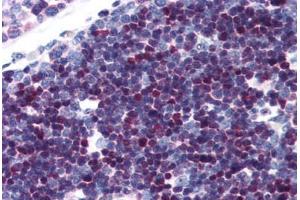 Human Thymus (formalin-fixed, paraffin-embedded) stained with SATB1 antibody ABIN343896 at 5 ug/ml followed by biotinylated goat anti-rabbit IgG secondary antibody ABIN481713, alkaline phosphatase-streptavidin and chromogen. (SATB1 Antikörper  (C-Term))