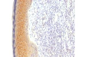 Formalin-fixed, paraffin-embedded human Skin stained with Catenin, gamma Monoclonal Antibody (CTNG/1483) (JUP Antikörper)