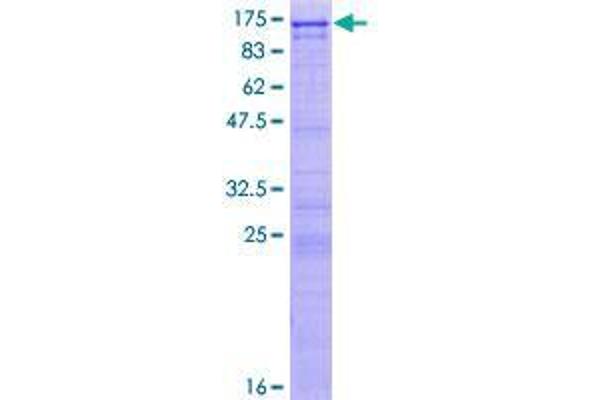 UTP14A Protein (AA 1-771) (GST tag)