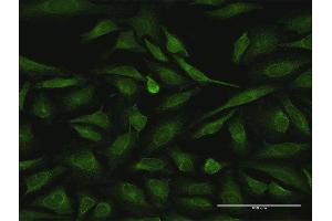 Immunofluorescence of purified MaxPab antibody to RIPK2 on HeLa cell. (RIPK2 Antikörper  (AA 1-540))