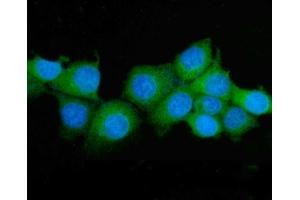 IF analysis of ASS1 using anti-ASS1 antibody (ABIN7601192). (ASS1 Antikörper  (AA 3-365))