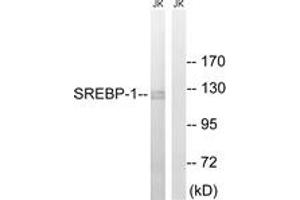Western blot analysis of extracts from Jurkat cells, treated with TNF 20ng/ml 30', using SREBP-1 (Ab-439) Antibody. (SREBF1 Antikörper  (AA 405-454))