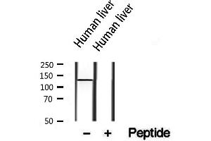 Western blot analysis of extracts from human liver, using PTPRO antibody. (PTPRU Antikörper  (Internal Region))