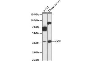 Western blot analysis of extracts of various cell lines, using VASP antibody (ABIN6134453, ABIN6150064, ABIN6150065 and ABIN6218508) at 1:3000 dilution. (VASP Antikörper  (AA 1-100))