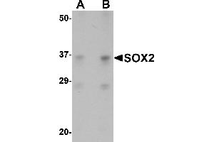 Western Blotting (WB) image for anti-SRY (Sex Determining Region Y)-Box 2 (SOX2) (N-Term) antibody (ABIN1031582) (SOX2 Antikörper  (N-Term))
