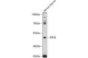 Western blot analysis of extracts of Mouse thymus, using DPH2 antibody (ABIN7266787) at 1:1000 dilution. (DPH2 Antikörper  (AA 120-330))