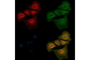 ABIN6261249 and ABIN6268912 staining  cells by IF/ICC. (DDR1 Antikörper  (C-Term))
