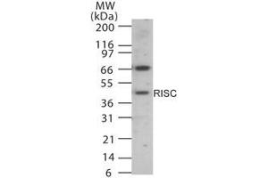 Image no. 1 for anti-serine Carboxypeptidase 1 (SCPEP1) (AA 28-43) antibody (ABIN233212) (SCPEP1 Antikörper  (AA 28-43))