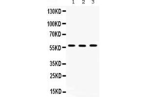 Western blot analysis of TCP1 beta expression in rat testis extract ( Lane 1), mouse spleen extract ( Lane 2) and SW620 whole cell lysates ( Lane 3). (CCT2 Antikörper  (AA 414-535))