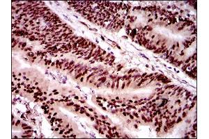 Immunohistochemistry (IHC) image for anti-Twist Homolog 1 (Drosophila) (TWIST1) (AA 9-74) antibody (ABIN1724845)