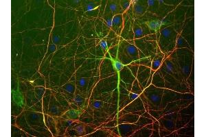 Embryonic rat cortical cells grown in tissue culture and stained with ABIN1580447 (green) and the phosphorylated axonal form of neurofilament NF-H, using CPCA-NF-H antibody (red).