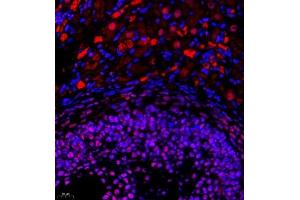 Immunofluorescence of paraffin embedded rat ovary using Skar (ABIN7074970) at dilution of 1:950 (400x lens) (p46 Antikörper)