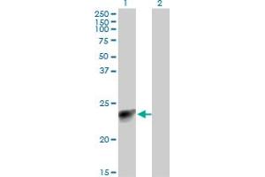 Western Blot analysis of MYL3 expression in transfected 293T cell line by MYL3 monoclonal antibody (M12), clone 4C2. (MYL3/CMLC1 Antikörper  (AA 1-195))
