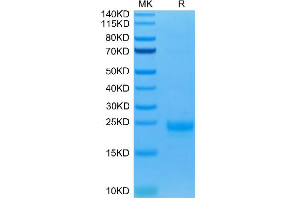 IL-5 Protein (AA 20-134) (His-Avi Tag,Biotin)