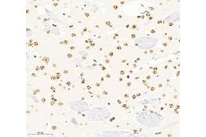 Immunohistochemistry analysis of paraffin-embedded mouse brain using,SETD2 (ABIN7075582) at dilution of 1: 3600