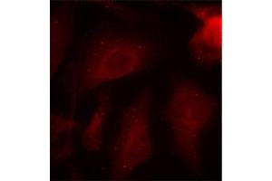 Immunofluorescence (IF) image for anti-Microtubule-Associated Protein tau (MAPT) (pSer404) antibody (ABIN1870403) (MAPT Antikörper  (pSer404))