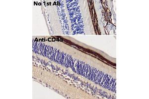 Immunohistochemistry (IHC) image for anti-Protein tyrosine Phosphatase, Receptor Type, C (PTPRC) (C-Term) antibody (ABIN6254210)