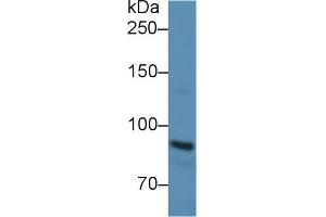 Western Blotting (WB) image for anti-Cadherin 1, Type 1, E-Cadherin (Epithelial) (CDH1) (AA 374-628) antibody (ABIN2901805)