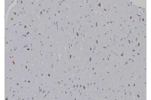 ABIN6277195 at 1/100 staining Human heart tissue by IHC-P. (Histone 3 Antikörper  (H3K9me))