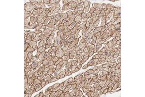 Immunohistochemical staining of human heart muscle with MAGED4B polyclonal antibody  shows strong membranous and cytoplasmic positivity in myocytes. (MAGED4B Antikörper)