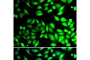 Immunofluorescence analysis of U2OS cells using PDIA6 Polyclonal Antibody (PDIA6 Antikörper)