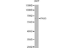 Western blot analysis of extracts of 293T cells, using PAX3 antibody (ABIN6290725) at 1:1000 dilution. (Paired Box 3 Antikörper)
