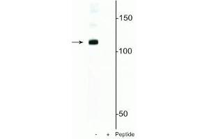 Western blot of mouse nuclei lysate showing specific immunolabeling of the ~120 kDa DGCR8 protein phosphorylated at in the first lane (-). (DGCR8 Antikörper  (pSer377))