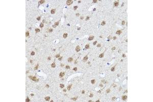 Immunohistochemistry of paraffin-embedded Rat brain using MYOCD antibody (ABIN7268730) at dilution of 1:100 (40x lens). (Myocardin Antikörper  (AA 650-750))
