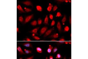Immunofluorescence analysis of U2OS cells using EZH2 Polyclonal Antibody (EZH2 Antikörper)