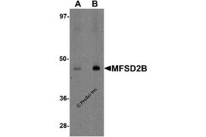 Western Blotting (WB) image for anti-Major Facilitator Superfamily Domain Containing 2B (MFSD2B) (Middle Region) antibody (ABIN1031004) (MFSD2B Antikörper  (Middle Region))