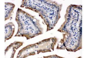 Anti- POR Picoband antibody,IHC(P) IHC(P): Mouse Intestine Tissue