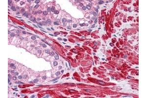 Human Prostate: Formalin-Fixed, Paraffin-Embedded (FFPE) (DPP8 Antikörper)