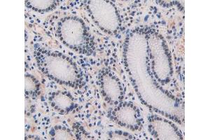 IHC-P analysis of stomach tissue, with DAB staining.