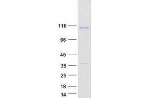Western Blotting (WB) image for GRIP and Coiled-Coil Domain Containing 1 (GCC1) protein (Myc-DYKDDDDK Tag) (ABIN2721758)