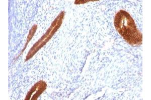 Image no. 3 for anti-Keratin 7 (KRT7) antibody (ABIN6170193) (Cytokeratin 7 Antikörper)