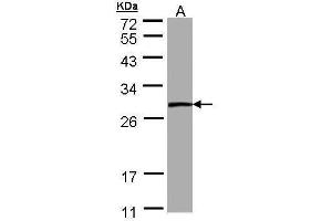 WB Image Sample (30 ug of whole cell lysate) A: A431 12% SDS PAGE antibody diluted at 1:1000