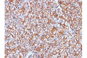 Formalin-fixed, paraffin-embedded human Pancreas stained with Spectrin beta III Mouse Monoclonal Antibody (SPTBN2/1778).