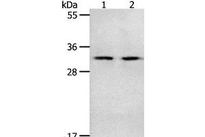 Western Blot analysis of Mouse spleen and intestinum crassum tissue using NME6 Polyclonal Antibody at dilution of 1:400