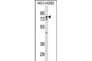 WRNIP1 Antibody (N-term) (ABIN1538893 and ABIN2838140) western blot analysis in NCI- cell line lysates (35 μg/lane).