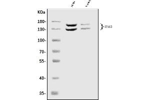 Western blot analysis of Astrin/Deepest/SPAG5 using anti-Astrin/Deepest/SPAG5 antibody (ABIN7602399). (SPAG5 Antikörper  (AA 738-1193))