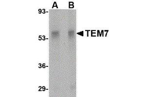 Western Blotting (WB) image for anti-Plexin Domain Containing 1 (PLXDC1) (Center) antibody (ABIN2476727)