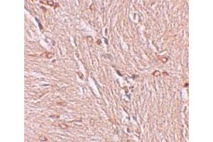 Immunohistochemical staining of human brain cells with ZBTB4 polyclonal antibody  at 2. (ZBTB4 Antikörper  (C-Term))