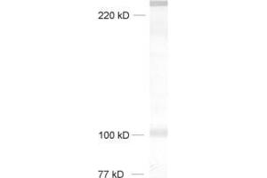 dilution: 1 : 1000, sample: rat brain homogenate (Neurobeachin Antikörper  (AA 952-1320))