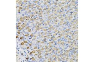Immunohistochemistry of paraffin-embedded mouse stomach using LDHB antibody.