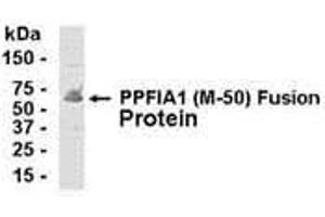 Western Blotting (WB) image for anti-Protein Tyrosine Phosphatase F Interacting Protein 1 (PPFIA1) (AA 310-360) antibody (ABIN2467996) (PPFIA1 Antikörper  (AA 310-360))