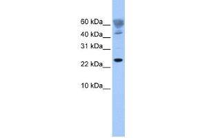 WB Suggested Anti-FUNDC1 Antibody Titration: 0. (FUNDC1 Antikörper  (Middle Region))