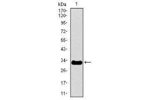 Image no. 2 for anti-Neurofilament, Heavy Polypeptide (NEFH) antibody (ABIN1491717) (NEFH Antikörper)