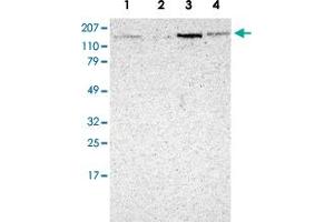 Western Blot analysis of Lane 1: RT-4, Lane 2: EFO-21, Lane 3: A-431 and Lane 4: human liver lysates with MAP3K9 polyclonal antibody . (MAP3K9 Antikörper)